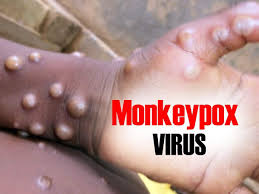 monkeypox.jpeg